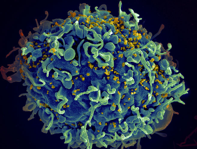 VIH: la prevenció demana pas